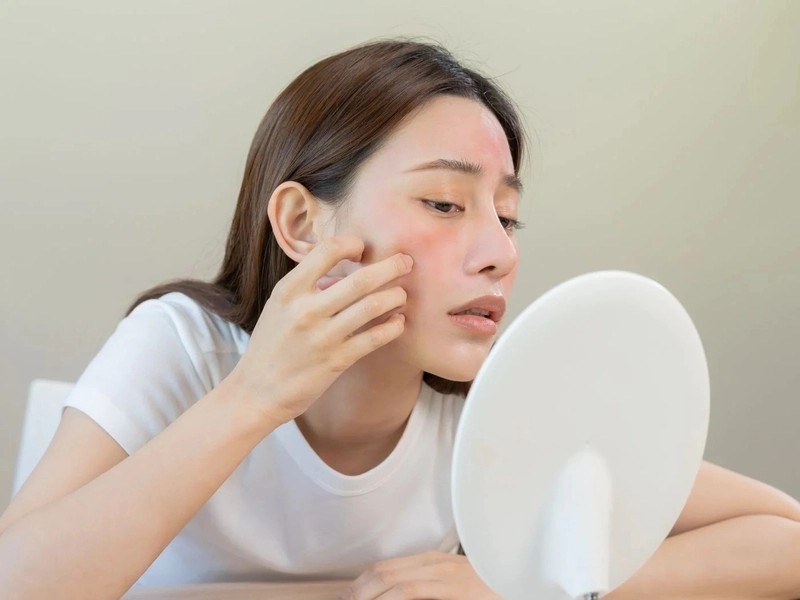 nhung sai lam khi su dung toner cho da dau gay kich ung va man do